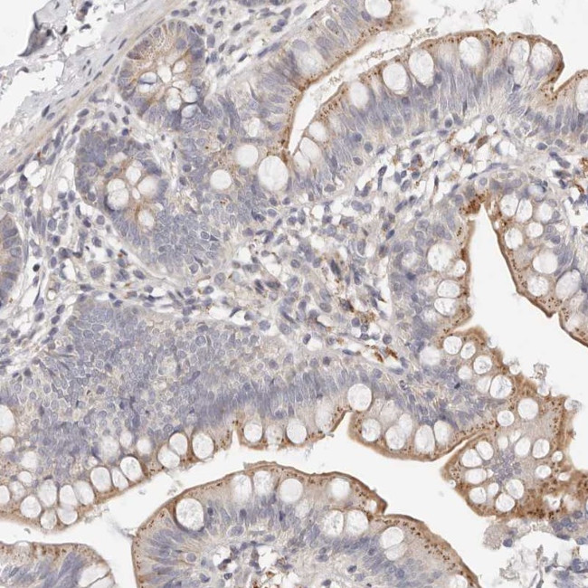 MYOM3 Antibody in Immunohistochemistry (Paraffin) (IHC (P))