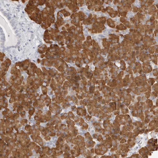 THEM4 Antibody in Immunohistochemistry (Paraffin) (IHC (P))