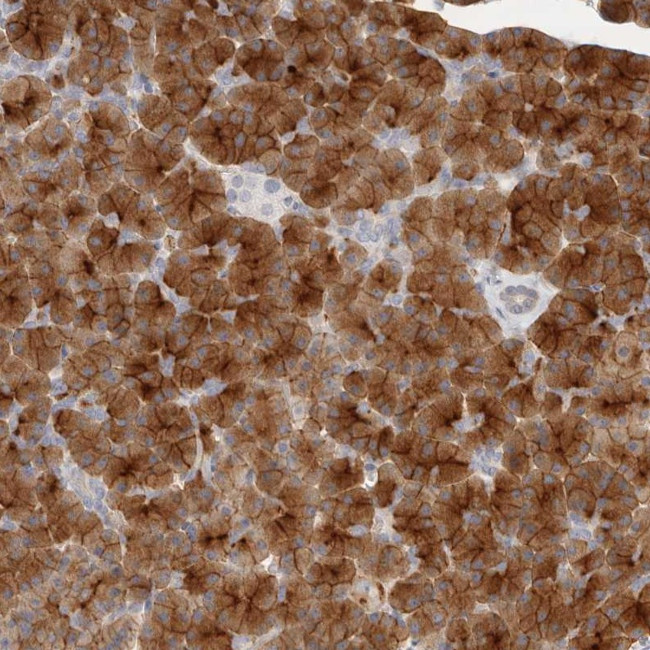 FAM129A Antibody in Immunohistochemistry (Paraffin) (IHC (P))