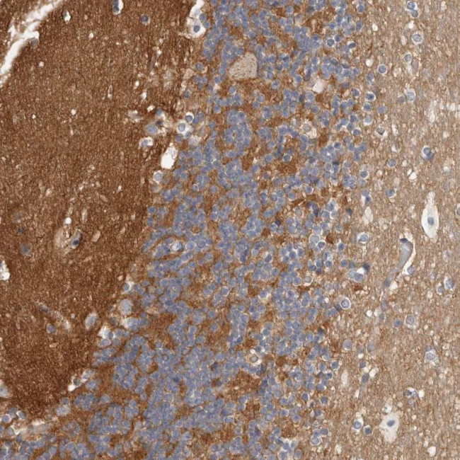 WDTC1 Antibody in Immunohistochemistry (Paraffin) (IHC (P))