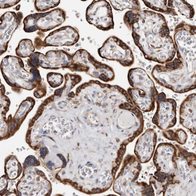 ACBD6 Antibody in Immunohistochemistry (Paraffin) (IHC (P))