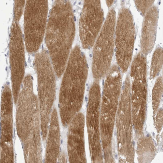 TMOD4 Antibody in Immunohistochemistry (Paraffin) (IHC (P))