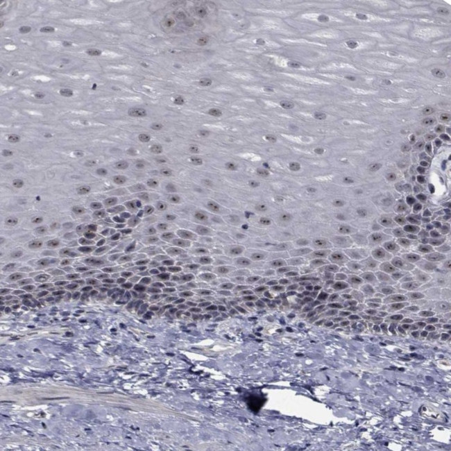 NVL Antibody in Immunohistochemistry (Paraffin) (IHC (P))
