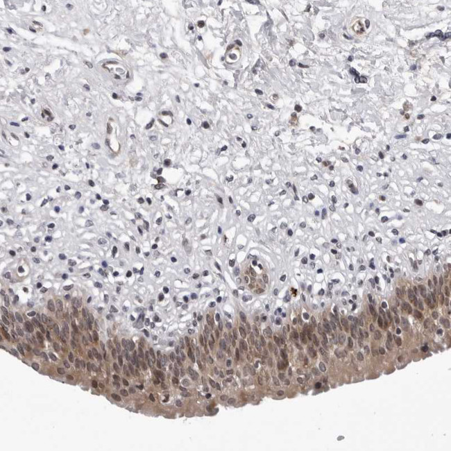 KIAA1614 Antibody in Immunohistochemistry (Paraffin) (IHC (P))
