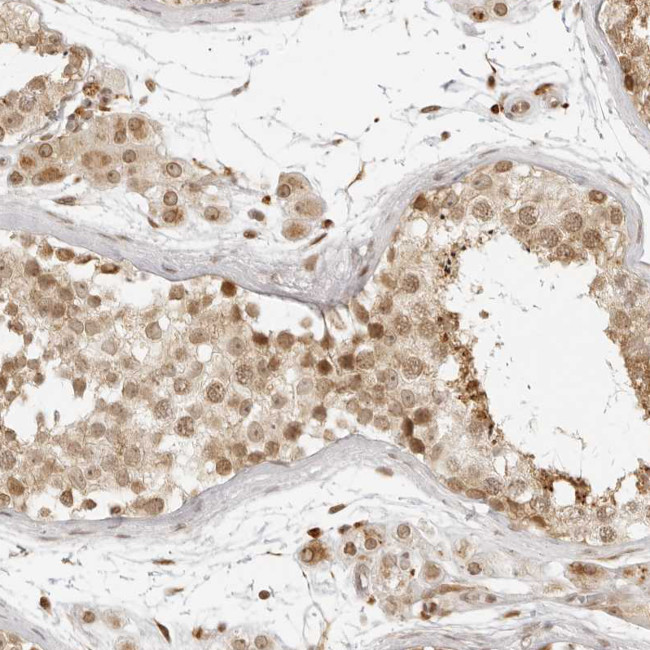 ZNF407 Antibody in Immunohistochemistry (Paraffin) (IHC (P))