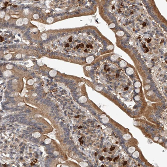 PLEKHG1 Antibody in Immunohistochemistry (Paraffin) (IHC (P))
