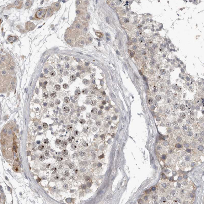C1orf216 Antibody in Immunohistochemistry (Paraffin) (IHC (P))