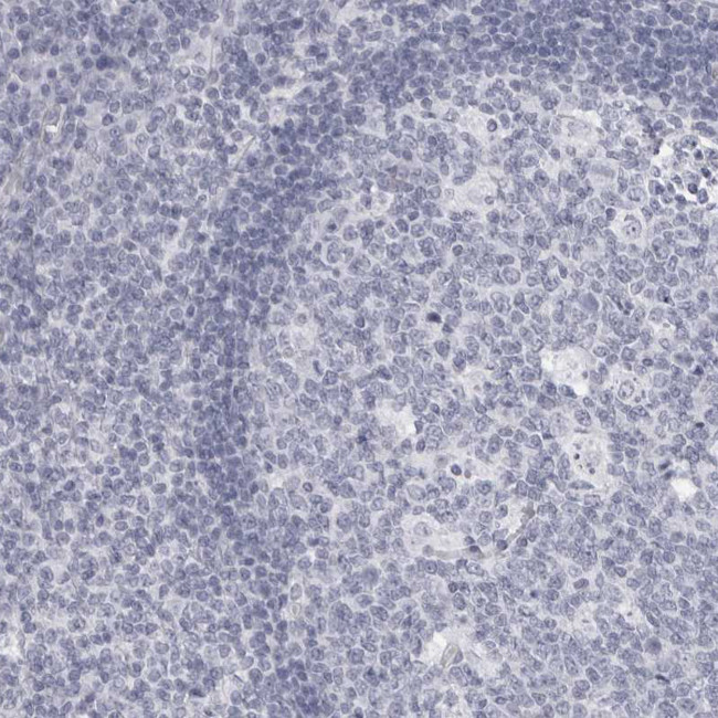DNALI1 Antibody in Immunohistochemistry (IHC)
