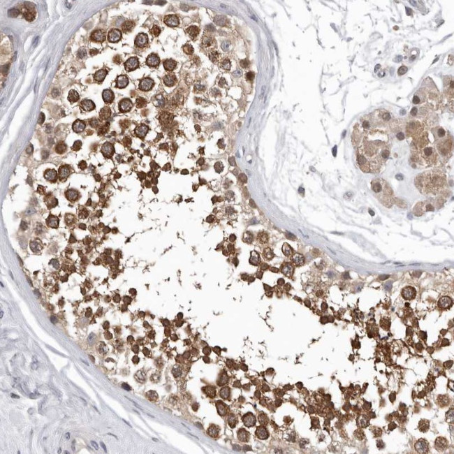 RALGPS2 Antibody in Immunohistochemistry (Paraffin) (IHC (P))
