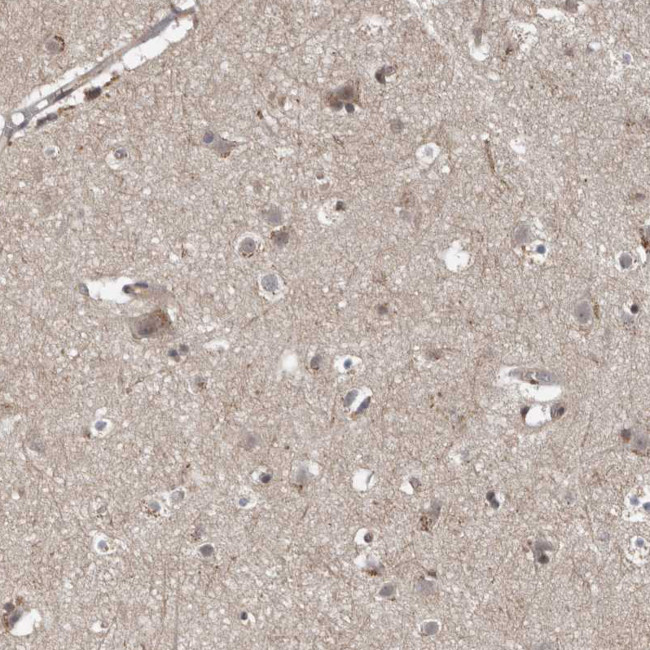FAM63A Antibody in Immunohistochemistry (Paraffin) (IHC (P))