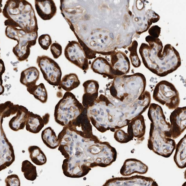 TCHH Antibody in Immunohistochemistry (Paraffin) (IHC (P))