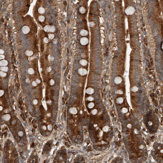 RNF207 Antibody in Immunohistochemistry (Paraffin) (IHC (P))