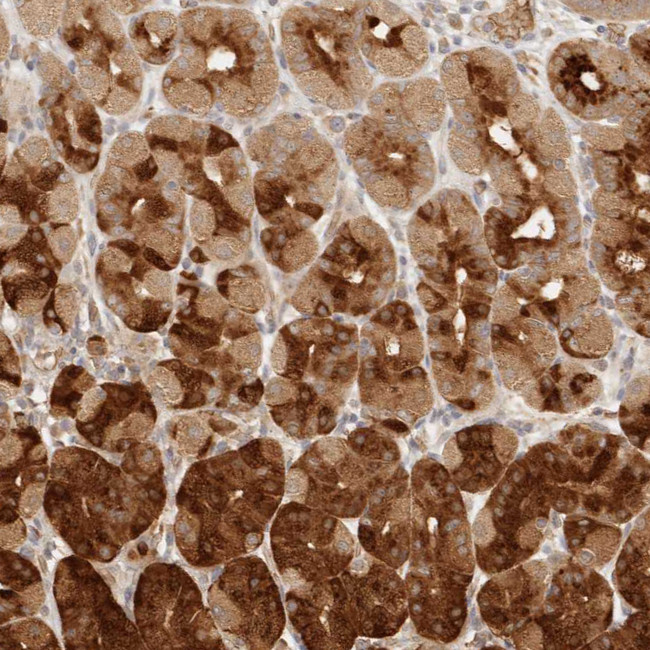 CPSF3L Antibody in Immunohistochemistry (IHC)