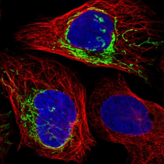 PLD5 Antibody in Immunocytochemistry (ICC/IF)