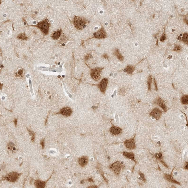 C1orf96 Antibody in Immunohistochemistry (Paraffin) (IHC (P))