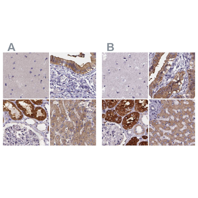PAH Antibody in Immunohistochemistry (IHC)