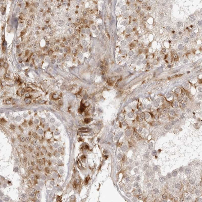 TCTEX1D1 Antibody in Immunohistochemistry (Paraffin) (IHC (P))