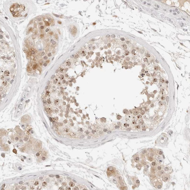 ARTS Antibody in Immunohistochemistry (Paraffin) (IHC (P))
