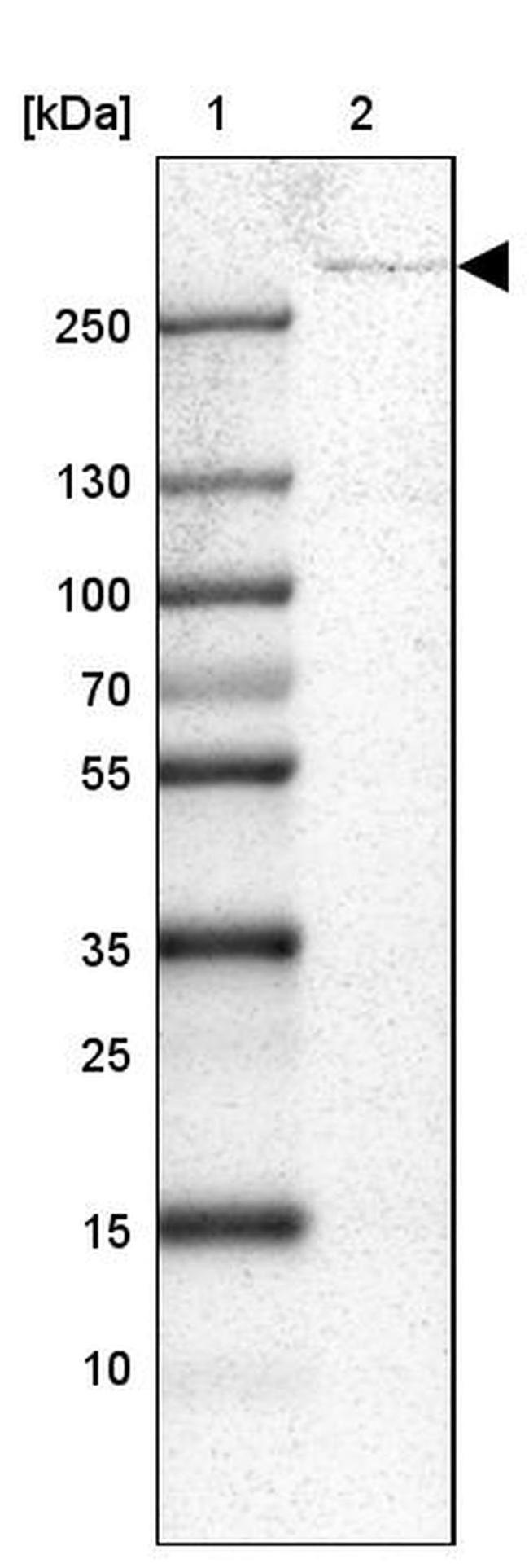 USP24 Antibody in Western Blot (WB)