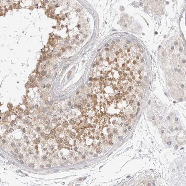C1orf102 Antibody in Immunohistochemistry (IHC)