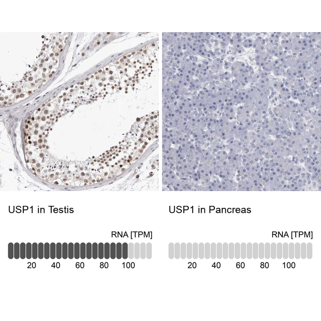 USP1 Antibody in Immunohistochemistry (Paraffin) (IHC (P))