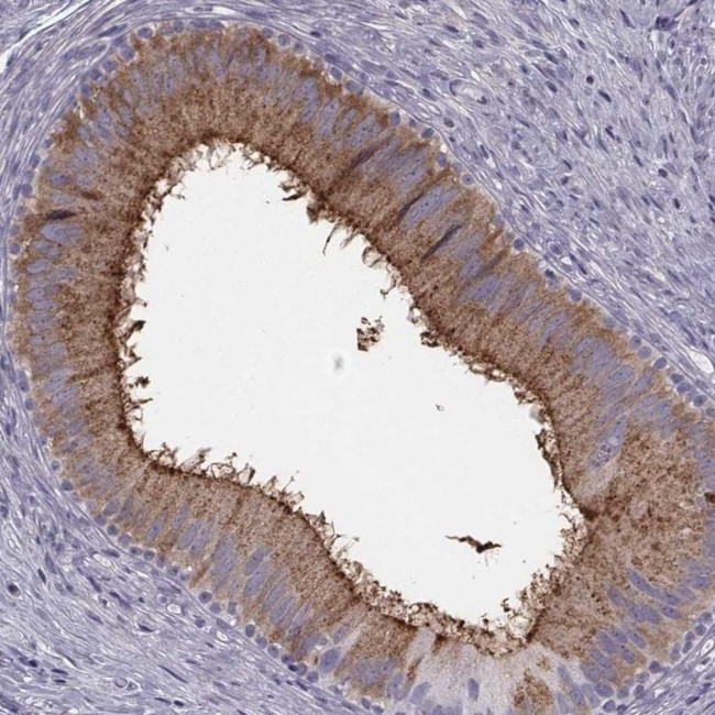 CRISP1 Antibody in Immunohistochemistry (IHC)