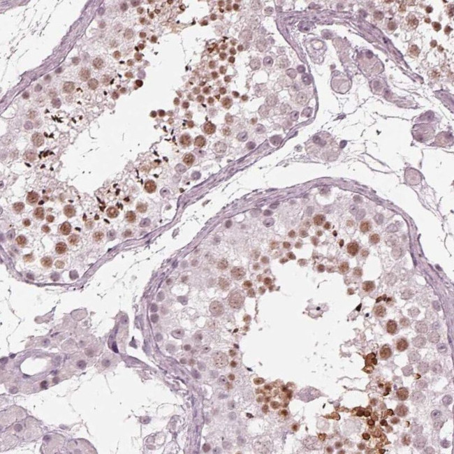 FAM71A Antibody in Immunohistochemistry (IHC)