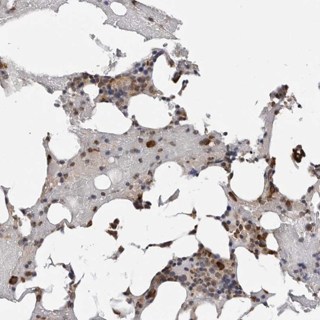 TRMT13 Antibody in Immunohistochemistry (Paraffin) (IHC (P))
