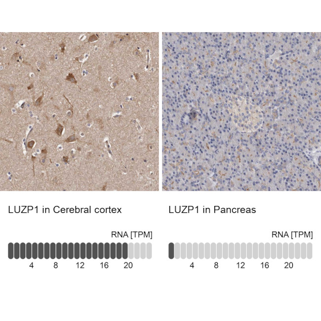 LUZP1 Antibody in Immunohistochemistry (IHC)