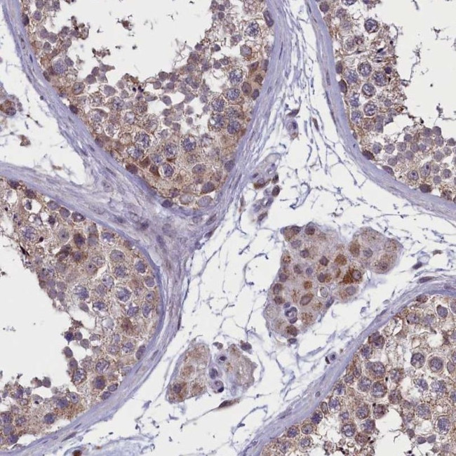 PARS2 Antibody in Immunohistochemistry (IHC)