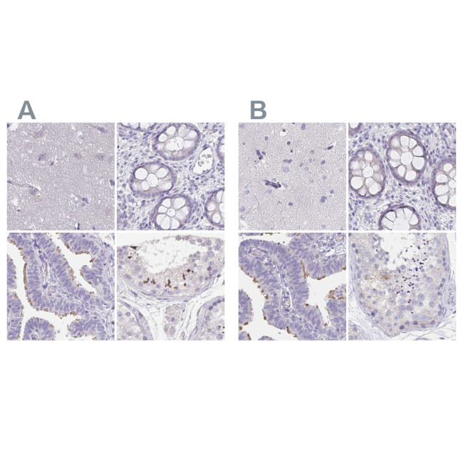 KIAA1751 Antibody in Immunohistochemistry (IHC)