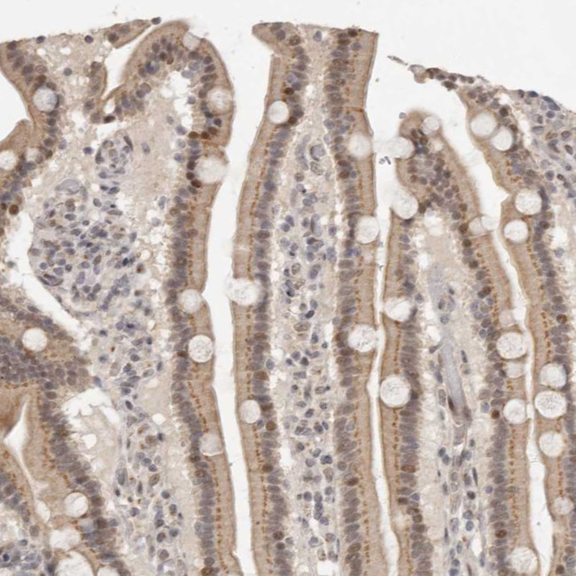LRRC75A Antibody in Immunohistochemistry (Paraffin) (IHC (P))