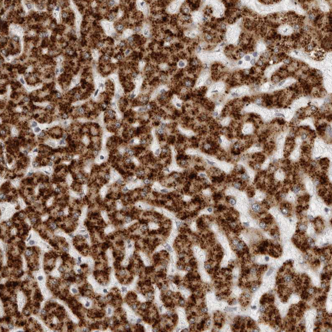 ACP6 Antibody in Immunohistochemistry (Paraffin) (IHC (P))