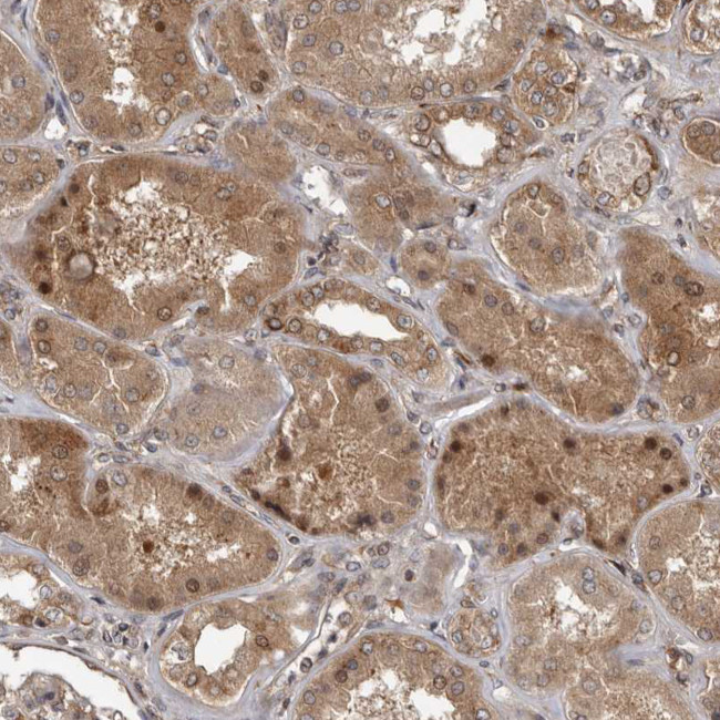 C1orf110 Antibody in Immunohistochemistry (Paraffin) (IHC (P))