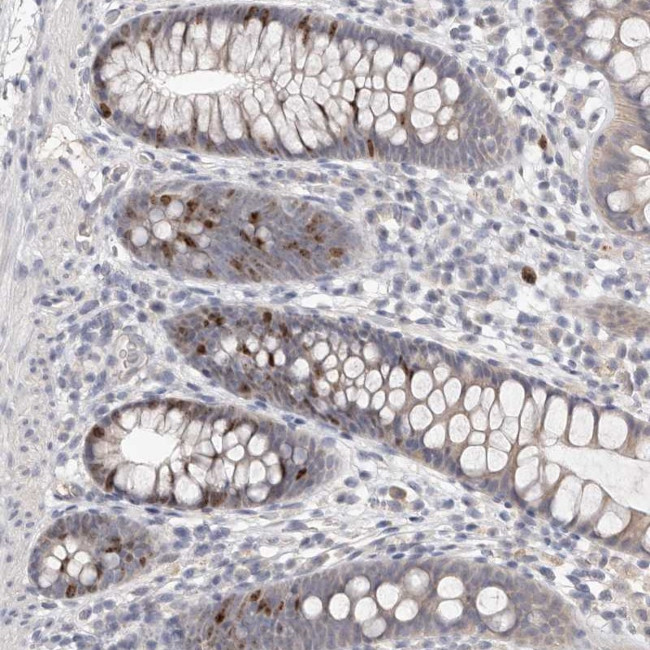 C1orf110 Antibody in Immunohistochemistry (Paraffin) (IHC (P))