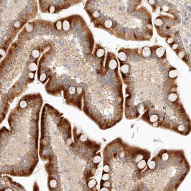 UBXD5 Antibody in Immunohistochemistry (IHC)