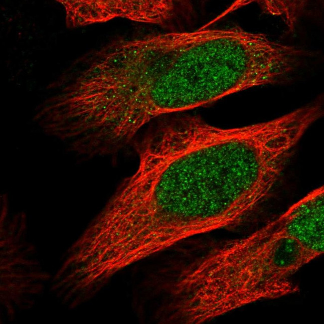 MTF1 Antibody in Immunocytochemistry (ICC/IF)