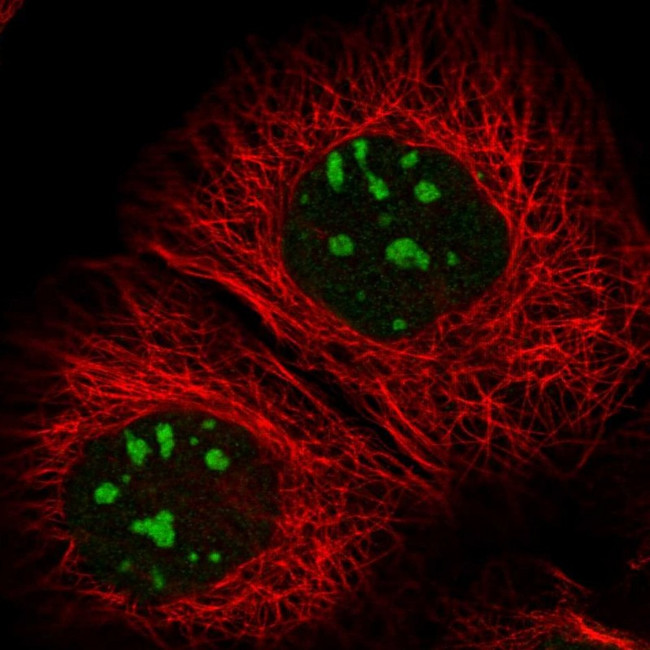 RBM34 Antibody in Immunocytochemistry (ICC/IF)