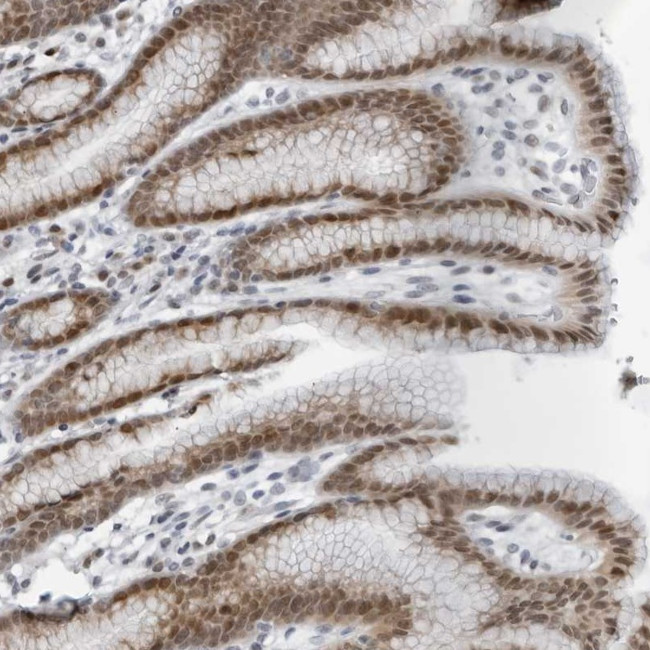 PPP1R42 Antibody in Immunohistochemistry (Paraffin) (IHC (P))