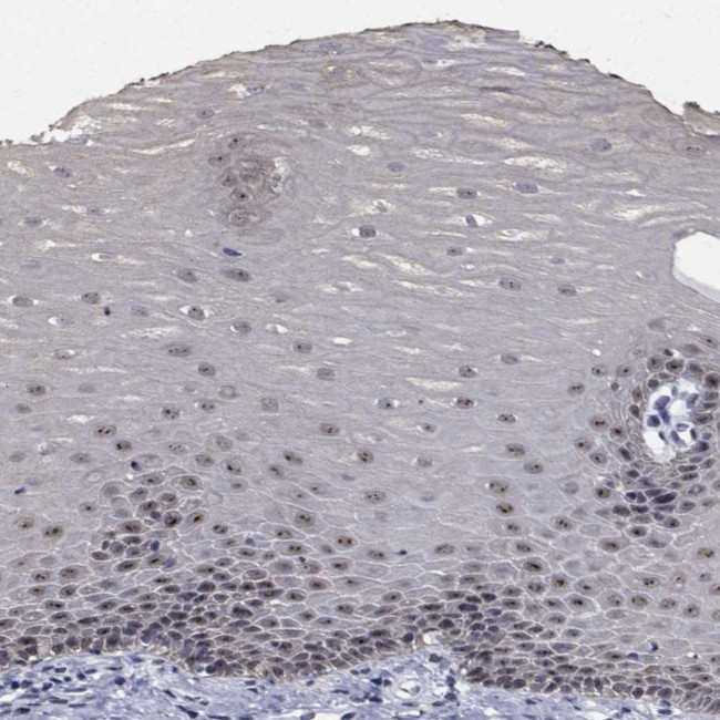 NVL Antibody in Immunohistochemistry (Paraffin) (IHC (P))