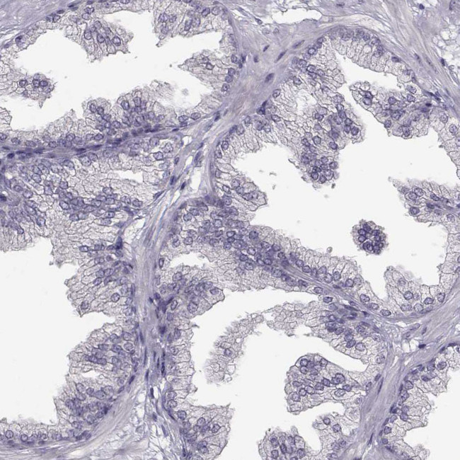 SPAG17 Antibody in Immunohistochemistry (Paraffin) (IHC (P))