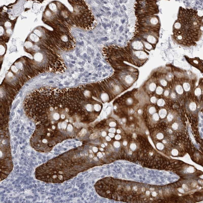 UROD Antibody in Immunohistochemistry (Paraffin) (IHC (P))