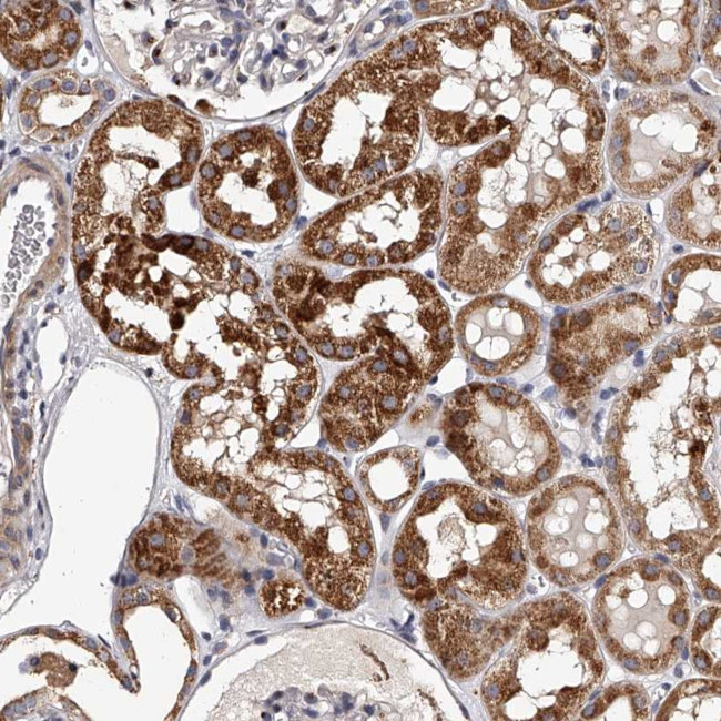 RSC1A1 Antibody in Immunohistochemistry (Paraffin) (IHC (P))