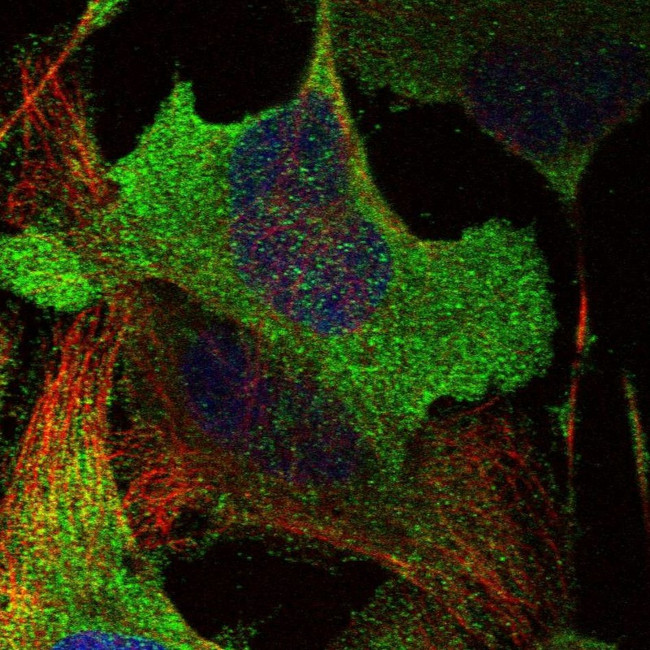 ADCK5 Antibody in Immunocytochemistry (ICC/IF)