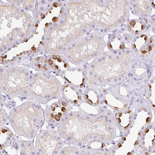 V-ATPase G3 Antibody in Immunohistochemistry (Paraffin) (IHC (P))