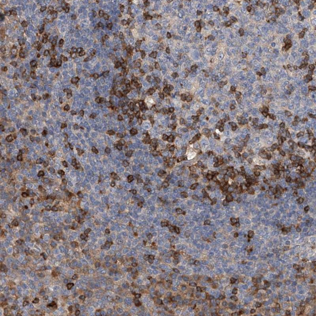 IPCEF1 Antibody in Immunohistochemistry (Paraffin) (IHC (P))