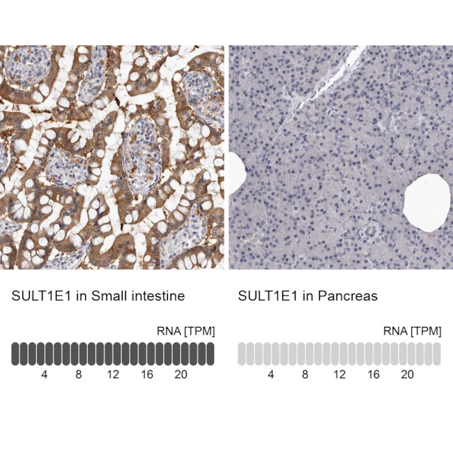 SULT1E1 Antibody in Immunohistochemistry (IHC)
