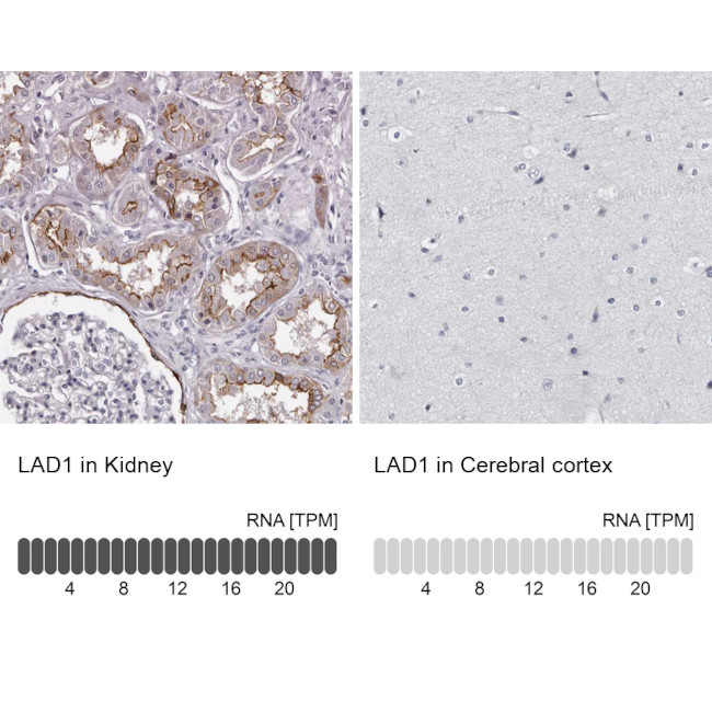 LAD1 Antibody in Immunohistochemistry (IHC)