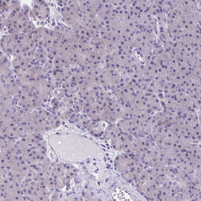 SLC12A3 Antibody in Immunohistochemistry (Paraffin) (IHC (P))