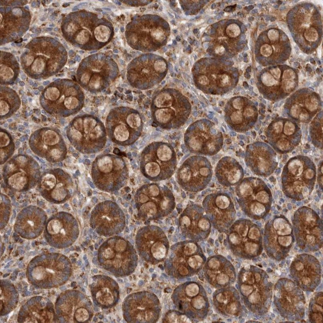 GOT1L1 Antibody in Immunohistochemistry (Paraffin) (IHC (P))